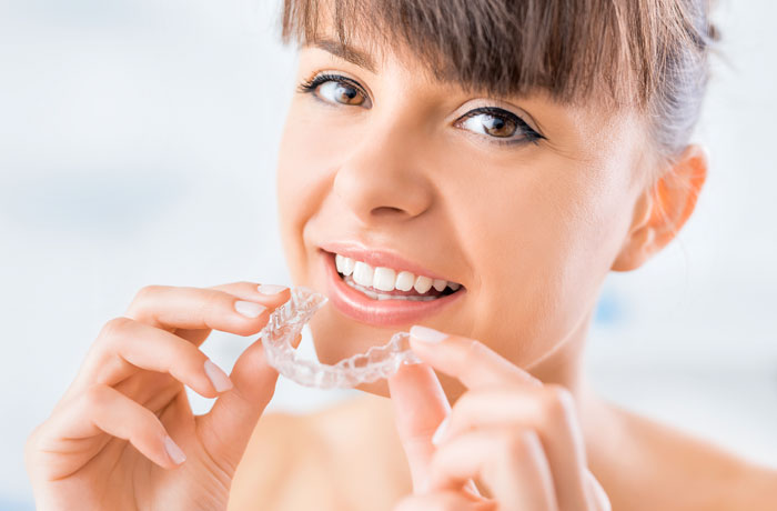 Invisilign, Orthocaps, Clear Aligner