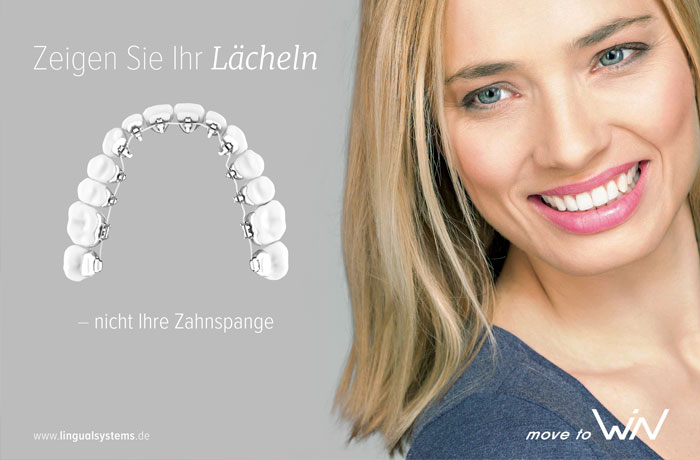 Lingual Brackets WiN